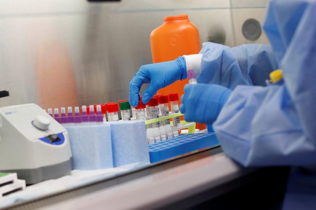 За последние сутки в регионе выявлено 16 новых случаев заражения коронавирусной инфекцией