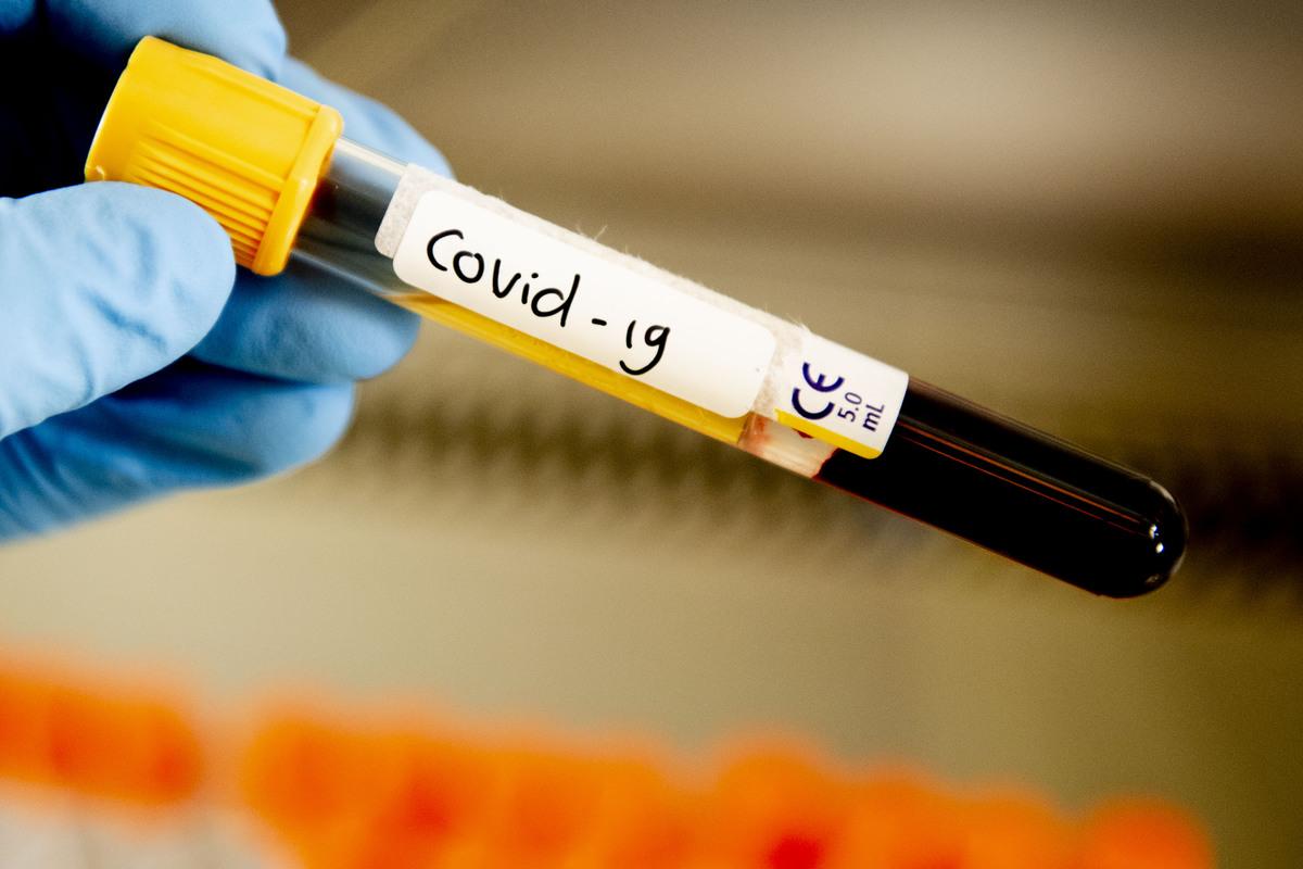 Почти 100 губахинцев проходят лечение от коронавируской инфекции в стационарах края и амбулаторно