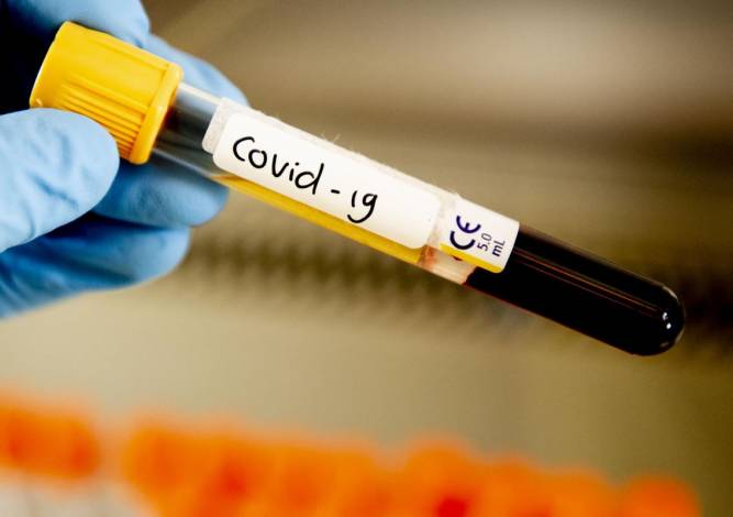 В Прикамье поставлен новый антирекорд по заболеваемости коронавирусом